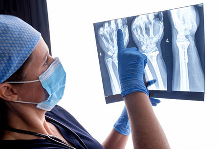 hand x-rays, hand and wrist injuries