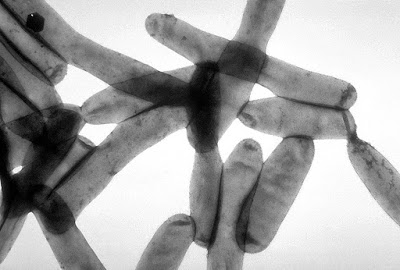 Legionella_pneumophila.jpg